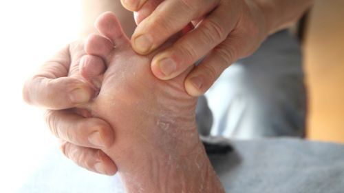 Identify diabetic foot syndrome from pictures