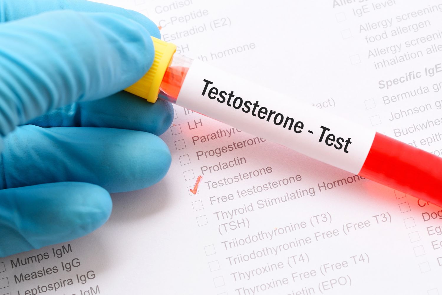 7 seltsame Fakten über testosteron bestellen