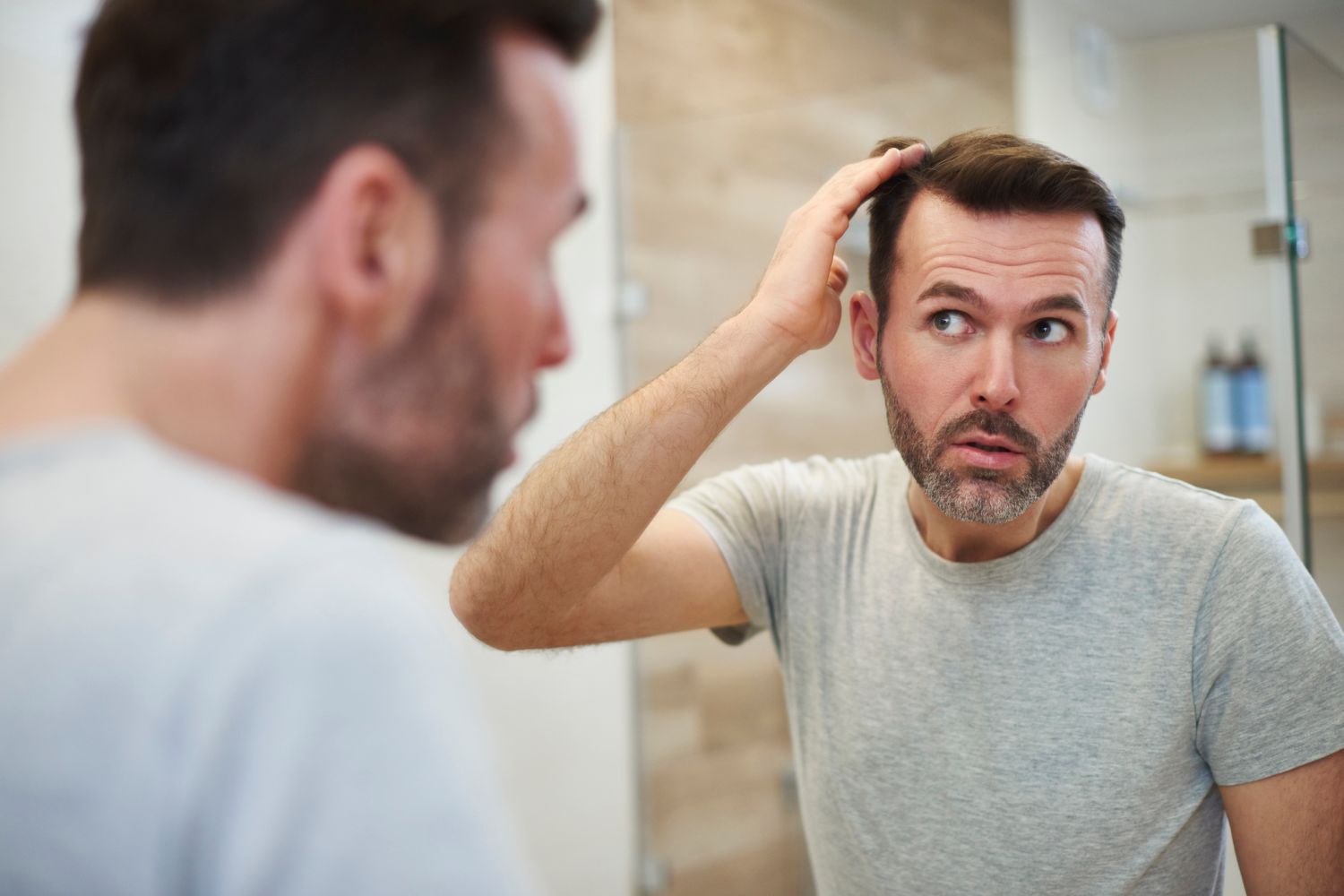 Männern haartransplantation bei deutschland in eine kostet was Haartransplantation: Das