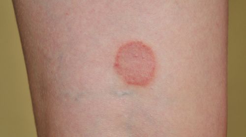 Identify skin diseases with these images