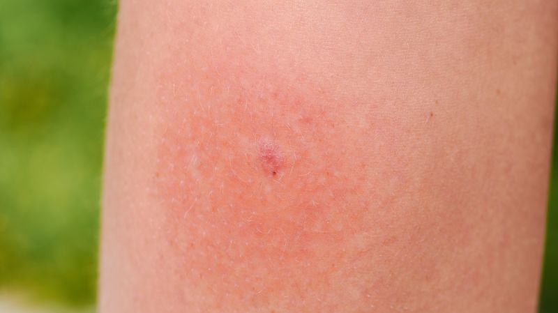 Mückenstich großer roter fleck