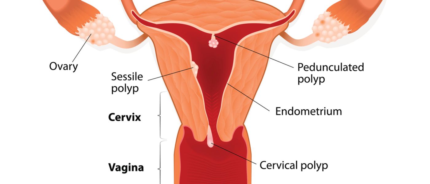 Plumper was uterus bedeutet Gebärmutter