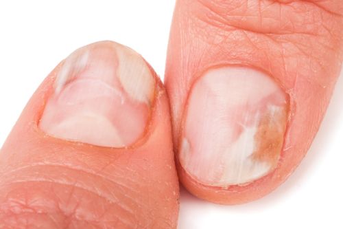 Nagelpflege 10 Tipps Fur Schone Gesunde Nagel