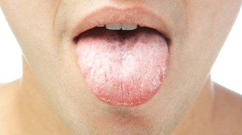 Der zunge auf knötchen Zungenpilz Ursachen